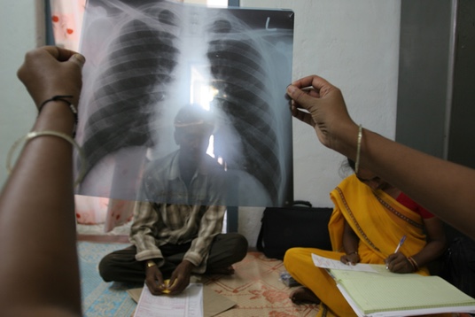 WARANGAL / ANDHRA PRADESH / JUNE 2005 At LODI's PLHA clinic. Photo: PRASHANT PANJIAR - LIVEWIRE IMAGES