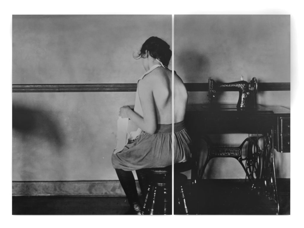 Lisa Oppenheim, Elizabeth Rudensky. Right dorsal curve. Scoliosis - real spinal case-bad. Showing wrong kind of occupation for this physical defect., 2016, Dye sublimation print on aluminum, diptych: Left panel 33 7/8 inches; Right panel 24 5/8 inches, 42 1/8 x 58 1/2 inches (overall). Courtesy of the artist and Tanya Bonakdar Gallery.